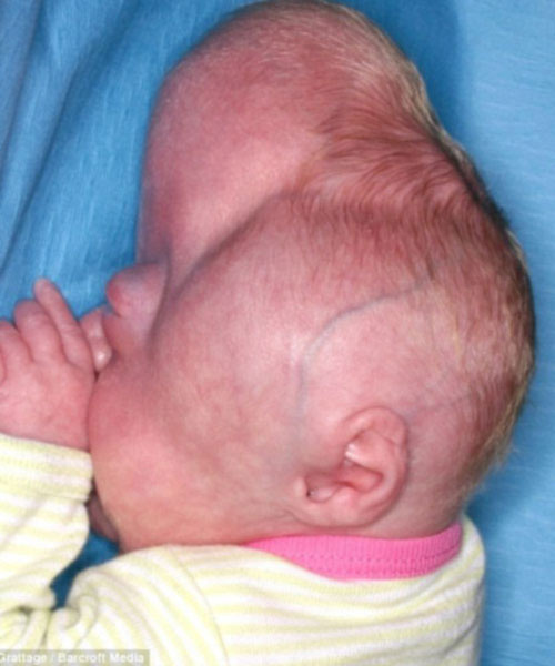 Bé gái có đầu hình cỏ ba lá - 2