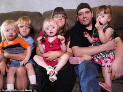 Bé gái có đầu hình cỏ ba lá - 3