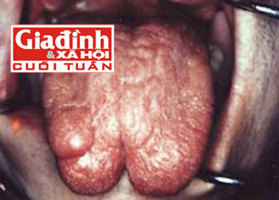 Thú chơi nong tai, xẻ lưỡi của giới trẻ Hà thành - 2