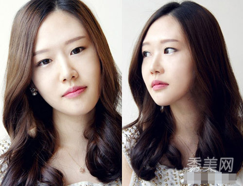 10 lọn xoăn yêu thích của thiếu nữ Hàn - 10