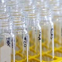 Thể thao - HOT: Gian nan cuộc chiến chống doping