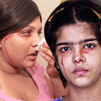 Phi thường - kỳ quặc - Những người khóc ra máu