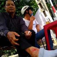 Pháp luật - Phóng xe đi cứu người, “hiệp sĩ” gặp tai nạn