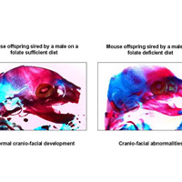 Sức khỏe đời sống - Dinh dưỡng của cha ảnh hưởng lớn tới con