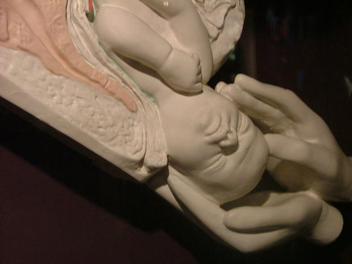 "Mùi của quỷ" nguy hiểm như thế nào? - 3