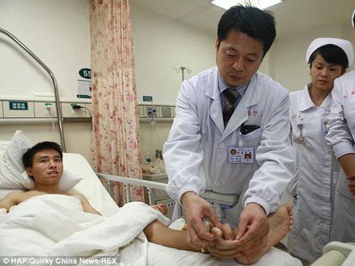 Kỳ lạ người đàn ông "mọc"... bàn tay ở mắt cá chân - 2