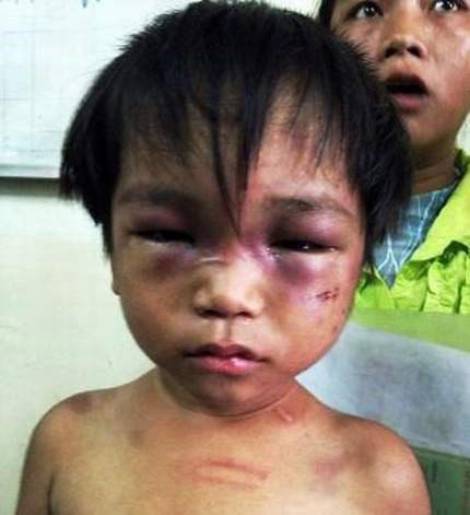 Quản không xuể nhóm trẻ gia đình tự phát - 3