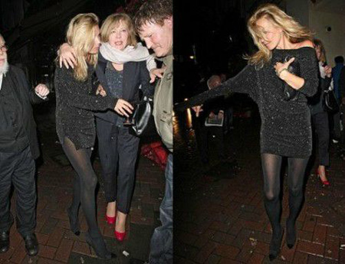Kate Moss Stairs Accident