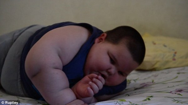 Bé trai 3 tuổi nặng…70kg - 1