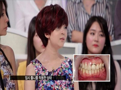 Cô gái mất nửa mặt tìm lại nhan sắc nhờ dao kéo - 5