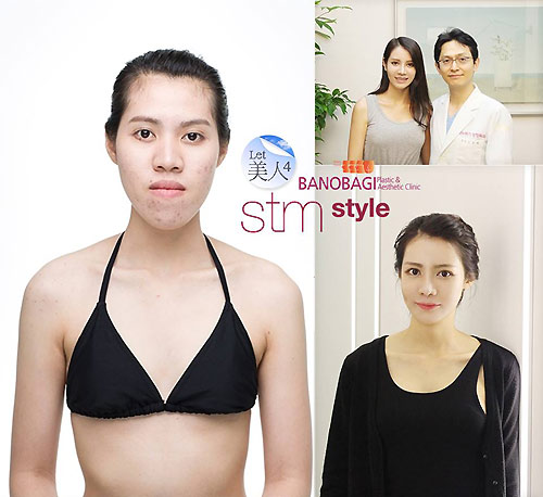 3 thiếu nữ Thái "xinh đẹp hơn tiên" nhờ dao kéo - 5