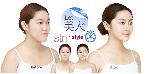 3 thiếu nữ Thái "xinh đẹp hơn tiên" nhờ dao kéo - 6