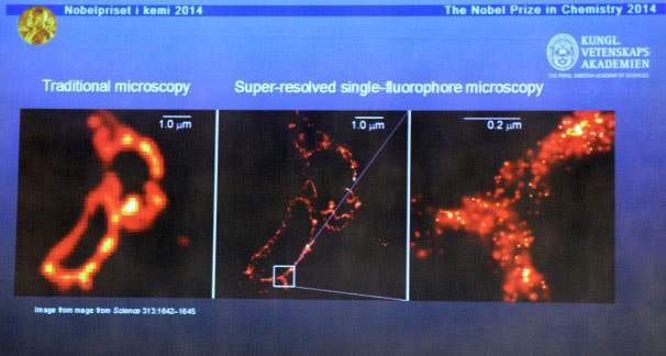 Giải Nobel Hóa học 2014 cho kính hiển vi siêu nét - 2