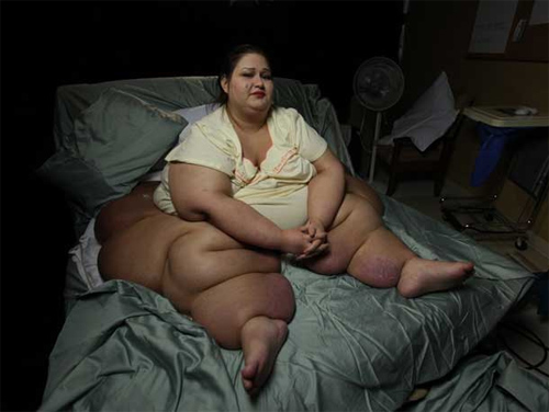 Rùng mình trước những thân hình lặc lè mỡ thừa - 2