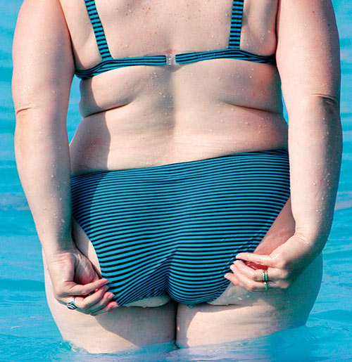 Rùng mình trước những thân hình lặc lè mỡ thừa - 4