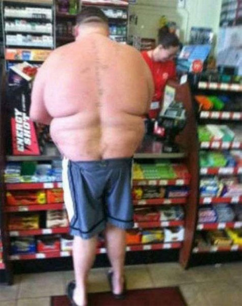 Rùng mình trước những thân hình lặc lè mỡ thừa - 10