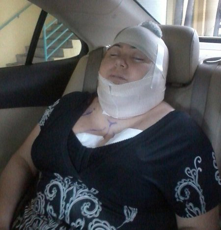 Bàng hoàng với 4 ca chết thảm vì phẫu thuật thẩm mỹ - 7