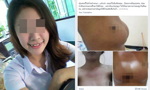 3 bộ phận dao kéo hỏng khiến mày râu khiếp đảm - 4