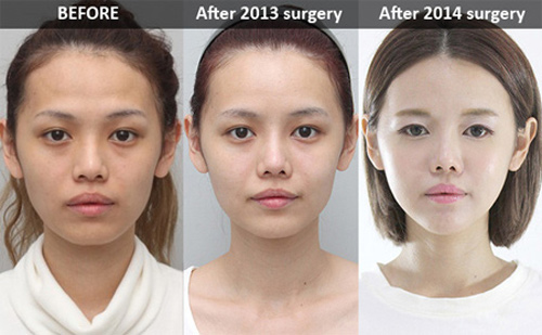 Hot girl Singapore bị "ném đá" vì dao kéo quá nhiều - 3