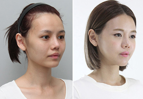 Hot girl Singapore bị "ném đá" vì dao kéo quá nhiều - 4