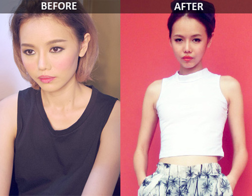 Hot girl Singapore bị "ném đá" vì dao kéo quá nhiều - 5