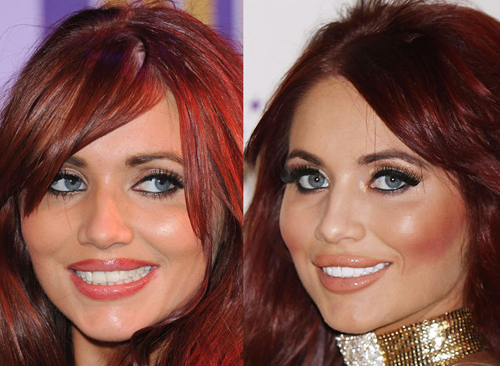 21 người nổi tiếng nên cảm ơn... nha sĩ - 12