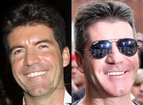 21 người nổi tiếng nên cảm ơn... nha sĩ - 13