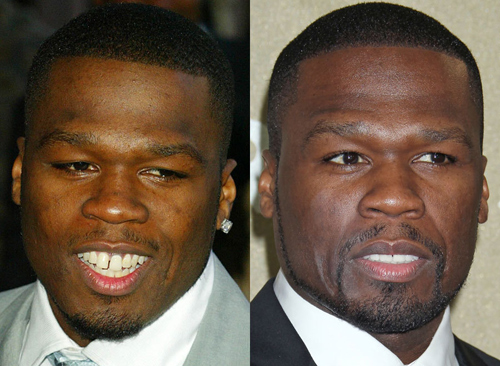 21 người nổi tiếng nên cảm ơn... nha sĩ - 2