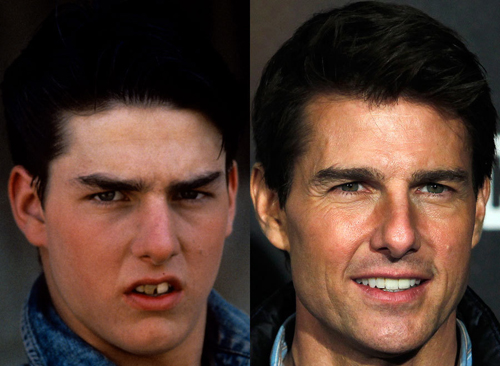 21 người nổi tiếng nên cảm ơn... nha sĩ - 2