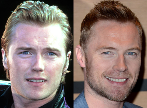 21 người nổi tiếng nên cảm ơn... nha sĩ - 7