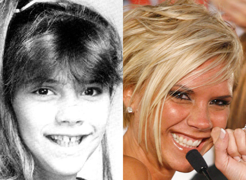 21 người nổi tiếng nên cảm ơn... nha sĩ - 4