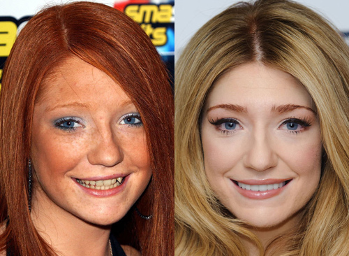 21 người nổi tiếng nên cảm ơn... nha sĩ - 6