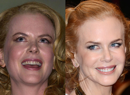 21 người nổi tiếng nên cảm ơn... nha sĩ - 7