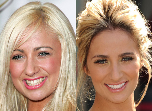 21 người nổi tiếng nên cảm ơn... nha sĩ - 8