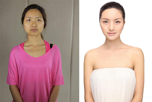 19 phụ nữ Trung Quốc trẻ, đẹp ngỡ ngàng nhờ thẩm mỹ - 1