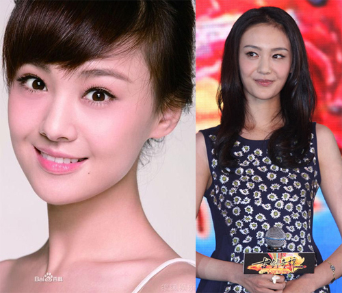 Bất ngờ vì mặt lệch, mồm méo của "người đẹp" showbiz - 3