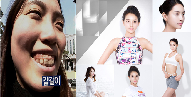 Park Dong Hee 23 tuổi có chiều cao lý tưởng 1m81 nhưng lại có gương mặt gồ ghề, hàm răng thô vẩu.&nbsp;

