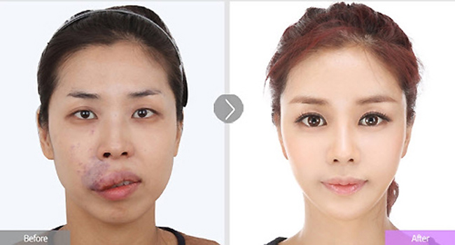 Kim Hee Eun là một&nbsp;chuyên viên thiết kế website.&nbsp;Kim Hee Eun có gương mặt không cân đối với&nbsp;một vết bớt tím đỏ, lan khắp phần môi trên và da mặt
