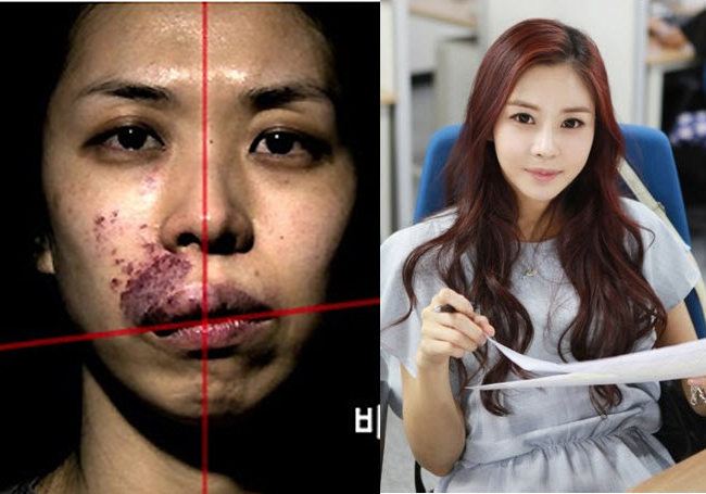 Từ một cô gái bị ví với quỷ,&nbsp;Kim Hee Eun đã có nhan sắc hơn người nhờ dao kéo.&nbsp;
