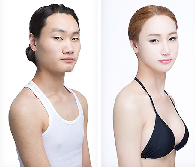 Chàng trai đồng tính được&nbsp;Jang Jong Woong được sống đúng với bản chất mình sau khi phẫu thuật thành nữ.&nbsp;
