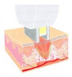 Trẻ hóa làn da toàn diện bằng chương trình điều trị Triniti - 2