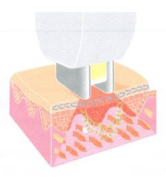 Trẻ hóa làn da toàn diện bằng chương trình điều trị Triniti - 3