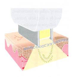 Trẻ hóa làn da toàn diện bằng chương trình điều trị Triniti - 4