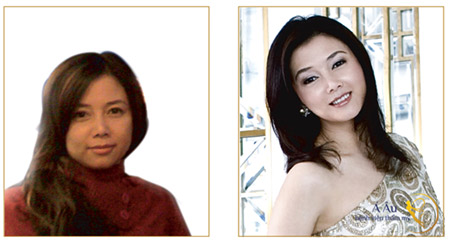 Căng da chỉ vàng nhận vàng miếng "mã đáo thành công" - 2