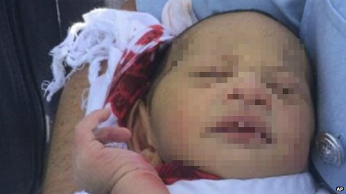 Úc: Bé sơ sinh bị mẹ vứt xuống cống suốt 5 ngày - 1