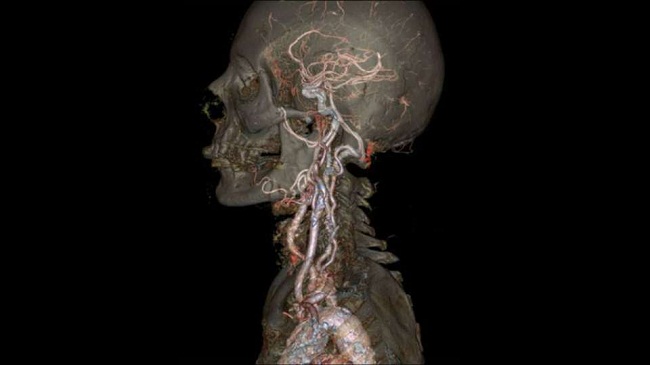 10 - Bức ảnh scan bên trong cơ thể người


