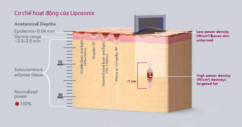 Giảm béo chỉ trong 60 phút để đón Giáng sinh và năm mới - 3