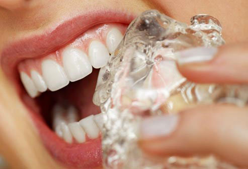 10 hành động khiến răng bạn dễ bị gãy - 1