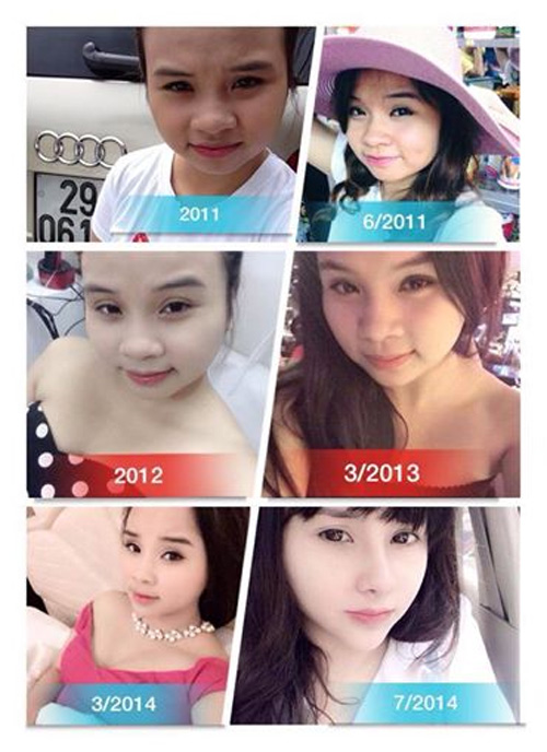 /Uploaded/phanthuhuong/2014_12_30/QQQD1419936046-4.jpg 4 cô gái đẹp lên nhờ “dao kéo” gây bất ngờ nhất năm 2014 - 3