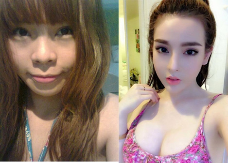 /Uploaded/phanthuhuong/2014_12_30/DYTA1419936046-6.jpg 4 cô gái đẹp lên nhờ “dao kéo” gây bất ngờ nhất năm 2014 - 5